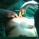 Desarrollan dos componentes que detienen la formación y expansión de los tumores de mama