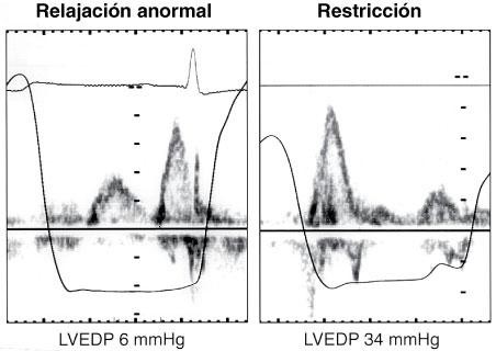 Ecocardiografía Doppler