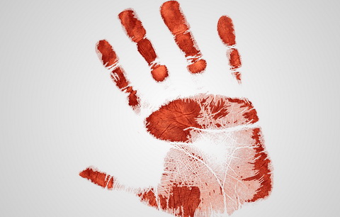 Etapa 4 Los Síntomas del Cáncer de Colon y Tratamientos